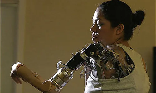 The Real Bionic Woman